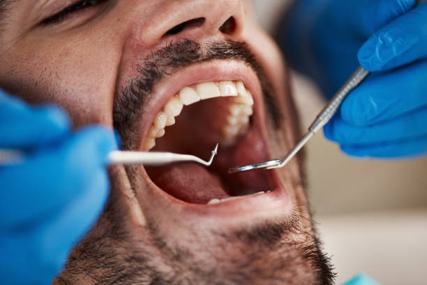 Best Dentist for Tooth Abscess  in Payne, OH