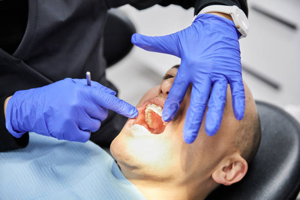 Best Knocked-Out Tooth Emergency  in Payne, OH